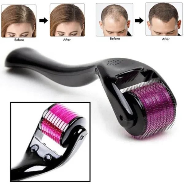 Derma Roller 0.5mm for Hair & Skin Therapy - Flashkart Pakistan