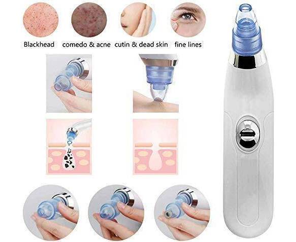 Blackhead Removal Machine | Derma Suction 3 In 1 Black Head Remover Machine | Acne Pimple Pore Cleaner Vacuum Suction Tool - Flashkart Pakistan