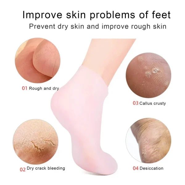 Silicone Jelly Socks | Box Packed | Ultra - Moisturizing Gel Foot Care Protector - Flashkart Pakistan