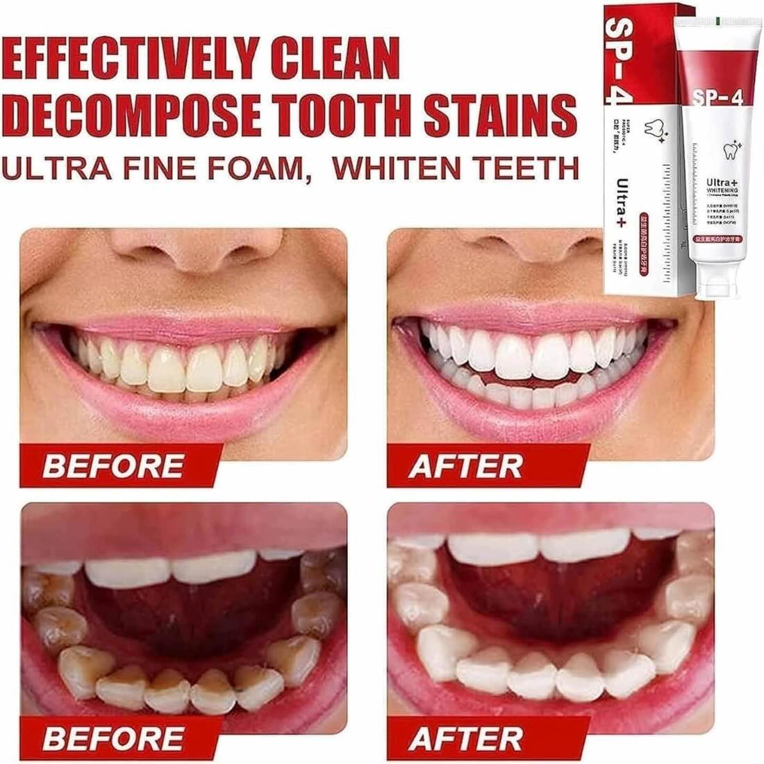 Yayashi SP - 4 Ultra Whitening Toothpaste | Stain Remover | Fresh Breath - Flashkart Pakistan